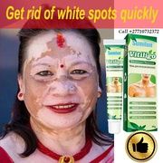 Get Rid Of Vitiligo In Borsbeek Municipality in Belgium And Vaasa City In Finland Call +27710732372 Scars And Stretch Marks In Buckeye City in Arizona, United States And Vereeniging City In South Africa