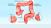 РАК СИГМОВИДНОЙ КИШКИ 1, 2, 3, 4 стадии степени.  Лечение в Киеве.