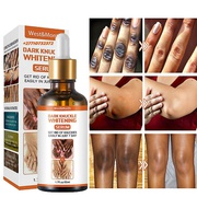 Dark Knuckle Whitening Serum In Geel City in Belgium, Elbow And Knee Brightening Serum In Paradise Valley Town in Arizona Call ? +2771 073 2372 Get Rid Of Tattoos In Polokwane City And Saldanha Town, Buy Dark Spots Products In Montagu Town In South Africa